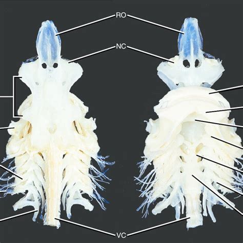 Dorsal And Ventral Views Of The Visceral Arches And Chondrocranium Of