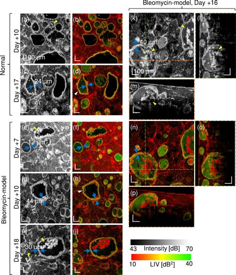 Figure 7 From Label Free Intratissue Activity Imaging Of Alveolar