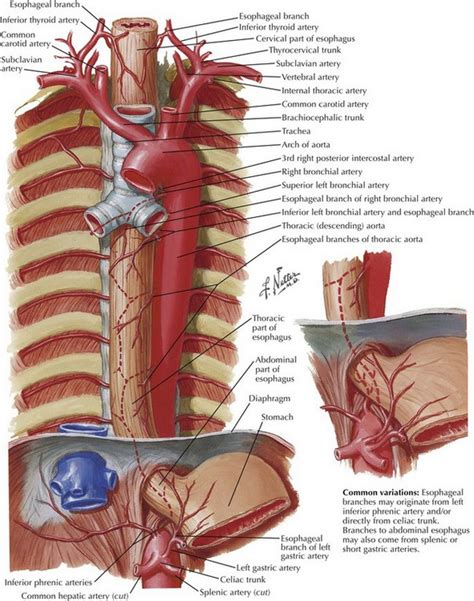 Nissen Fundoplication Basicmedical Key