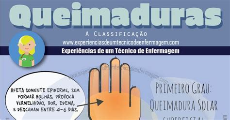 Queimaduras Classificações Enfermagem Ilustrada Enfermagem