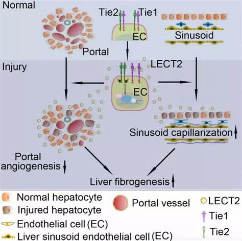 Cell 周伟杰团队揭示肝纤维化与血管新生新机制 南方医科大学