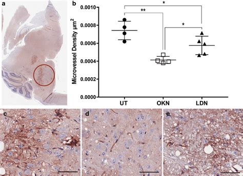 OKN 007 Decreases Micro Vessel Density MVD Better Than LDN 193189 In