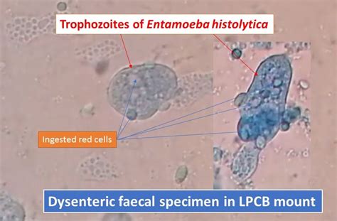 Entamoeba Histolytica Microscope