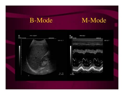 Physical Principles Of Ultrasound