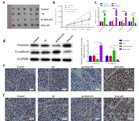 Malat Promoted Tumor Growth By Regulating The Expression Of Mir P