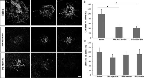 Effect Of Pedf Transfected Rat Rpe And Ipe Cells On Neovascularization