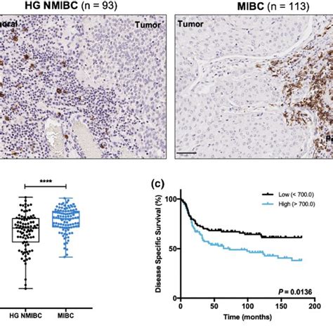 Cd68 And Cd163 Expression Is Substantially Higher In Mibc Than In Hg