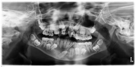 Ijerph Free Full Text Incidental Pathologic Findings From