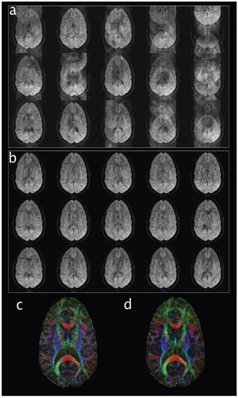 Figure 1 From A Robust Multi Shot Scan Strategy For High Resolution