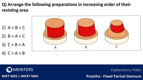 Neet Mds Inicet Prostho Fpd Principles Of Tooth Preparation