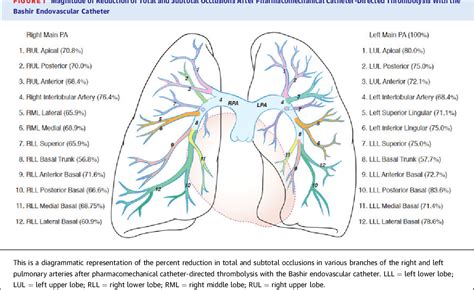 Figure From Effect Of Pharmacomechanical Catheter Directed