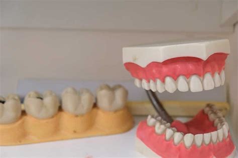 Everything You Need To Know About Mail Order Dentures