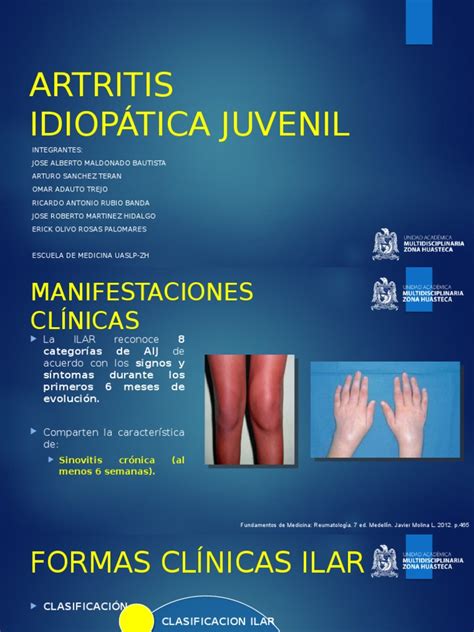 Artritis Idiopática Juvenil Pdf