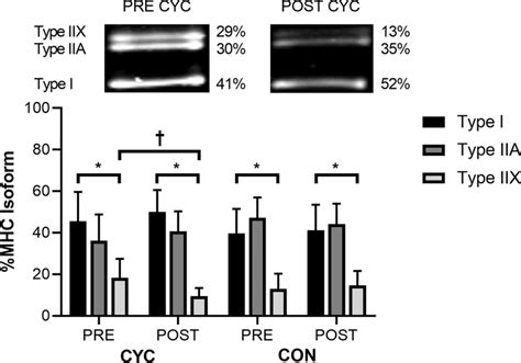 Top Electrophoretic Separation Of Myosin Heavy Chain Mhc Isoforms