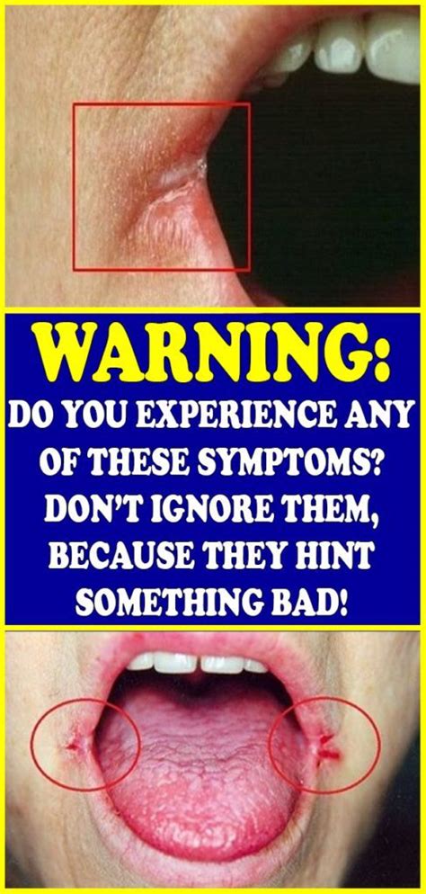 A Woman S Tongue With The Caption Warning Do You Experience Any Of These Symptoms Don T Ignore