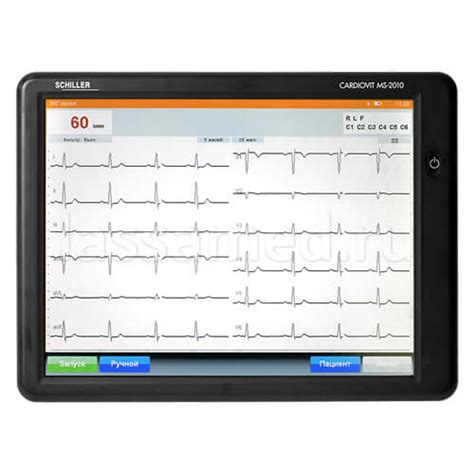 Электрокардиограф 6/12-канальный Cardiovit MS-2010/C купить в Москве ...