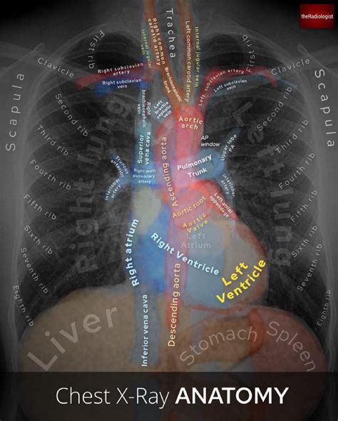 Chest radiograph at a glance. : r/FOAMed911