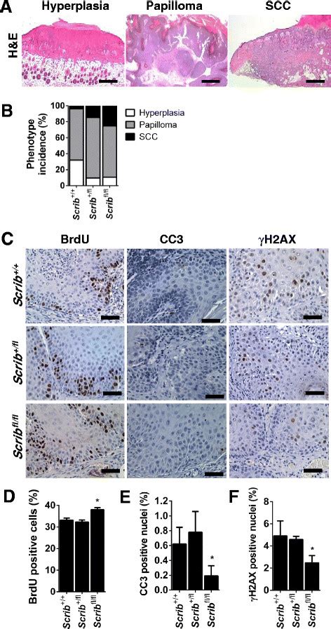 Scrib Depletion Promotes DMBA TPA Induced Epidermal Tumor Progression