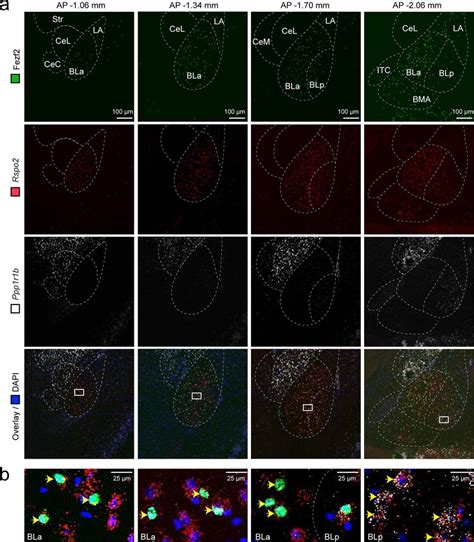 Fezf2BLa Neurons Are Predominately Rspo2 Neurons A Confocal Images Of