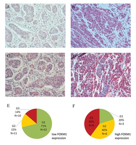 Foxm1 A Novel Drug Target In Gastroenteropancreatic Neuroendocrine