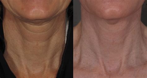 All About The Neck — Dr. Katie Beleznay