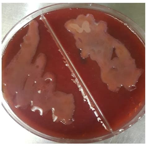 Isolation And Characterization Of Klebsiella Spp And Staphylococcus