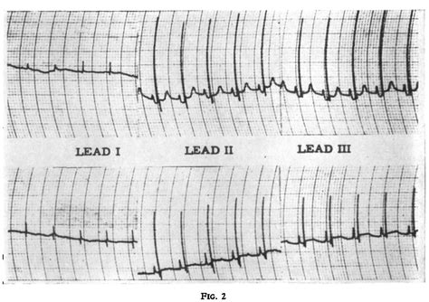 Figure From The Effect Of Halothane On The Isolated Cat Heart