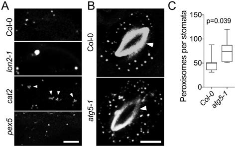 Staining of peroxisomes in mutants with known abnormalities of ... 