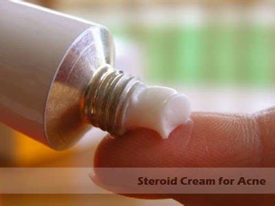 Are Steroid Cream for Acne is Bad? | Hormonal Acne Tips