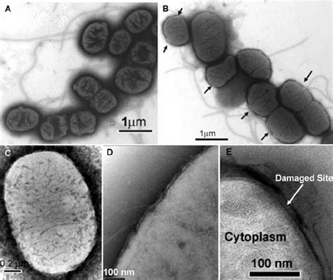 EFTEM images of E. coli cells. (A) Untreated E. coli . Flagella can be ...