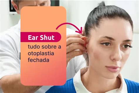 Ear Shut Tudo Sobre A Otoplastia Fechada