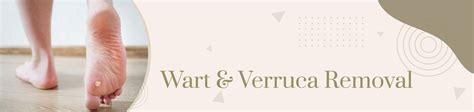 Wart & Verruca Removal - Harley Street Clinic Surrey & Harpenden