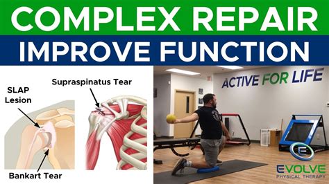 Complex Repair Improving Shoulder Girdle Function Part 2 Youtube