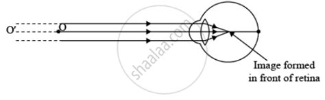 draw ray diagram showing myopic eye science shaalaacom