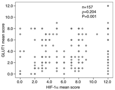 Prognostic Impact Of The Combination Of Hif‑1α And Glut1 In Patients