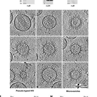 Microvesicles Expressing Full Length GB Coexpressed With SS55 Fab A