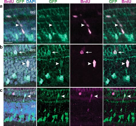 Late Stage Neuronal Progenitors in the Retina Are Radial Müller Glia