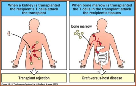 And Transplantation Immunology Flashcards Quizlet