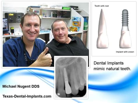 Dr Michael Nugent Is A Leading Pasadena Texas Dentist That Is A