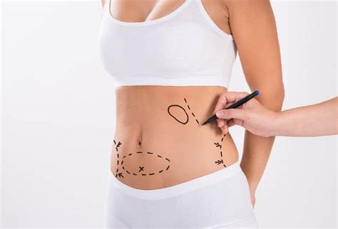 Liposuction Recovery Speed It Up With This Comprehensive Guide And