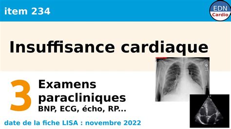 Insuffisance Cardiaque Partie Examens Paracliniques Youtube