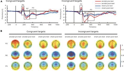 Frontiers Anodal Transcranial Direct Current Stimulation Tdcs Over