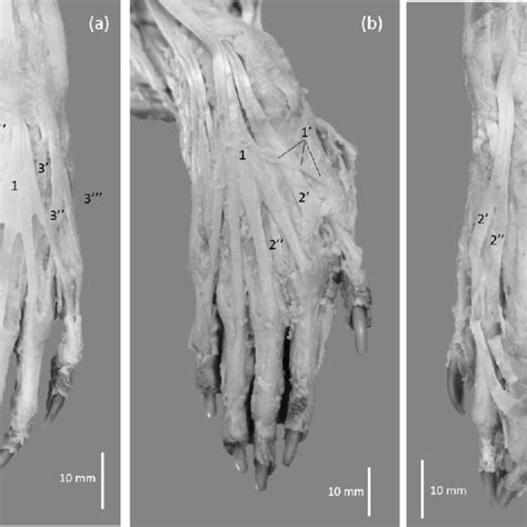 lateral views   left forearm    extensor digitorum