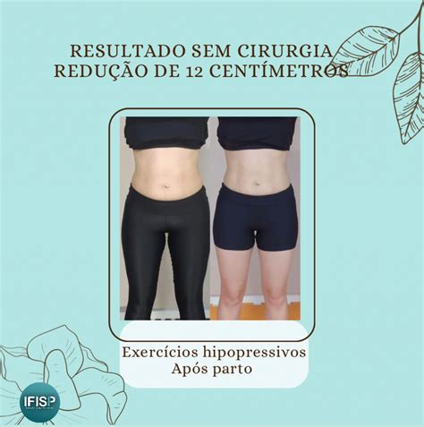 Hipopressivos Antes E Depois - Exercícios hipopressivos após o parto - IFISP Instituto de Fisioterapia ...