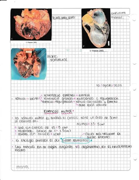 Lesiones Card Acas Valvulares Patolog A Aleja Huertas Udocz