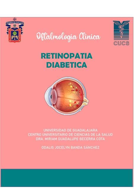 Resúmenes de Retinopatía diabética Descarga apuntes de Retinopatía