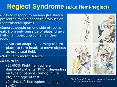 PPT - Parietal Lobe PowerPoint Presentation - ID:422847