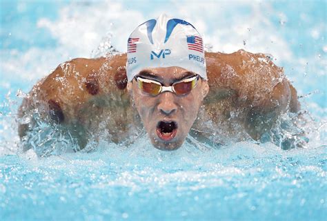 Michael Phelps' cupping therapy draws Olympic attention | Modern Healthcare