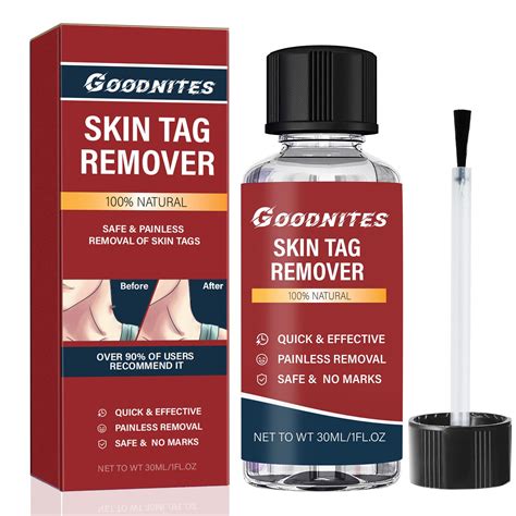 Goodnites Fast-acting Skin Tag Removal Kit, Natural and Gentle