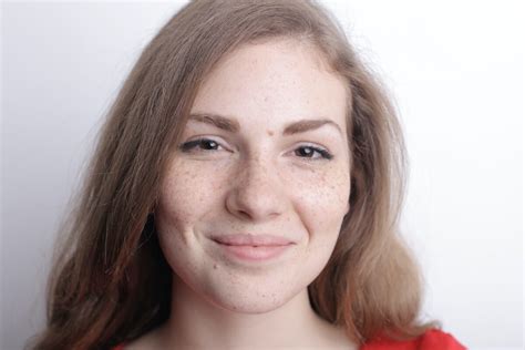 Skin Spots From Sun (Face): What To Look For And When To See a Doctor ...
